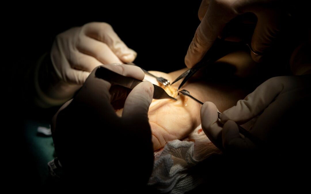 7 Verdades Sobre Cirurgias da Mão Que Ninguém Te Conta (A Quarta Vai Te Surpreender)